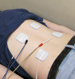 electrotherapy